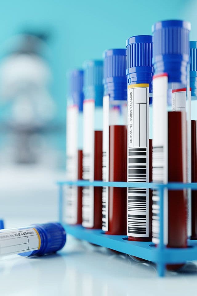 Quais são os níveis ideais de colesterol no sangue?