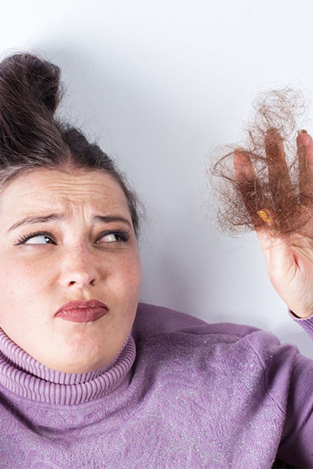 Calvície feminina: saiba mais sobre o tema e como tratá-la