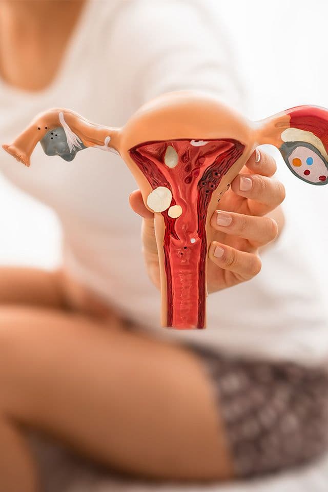 Endometriose: por que tantas mulheres convivem com os sintomas por anos antes do diagnóstico?