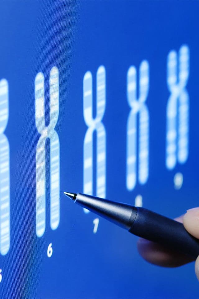 Cromossomopatia: detecção de síndromes genéticas no feto