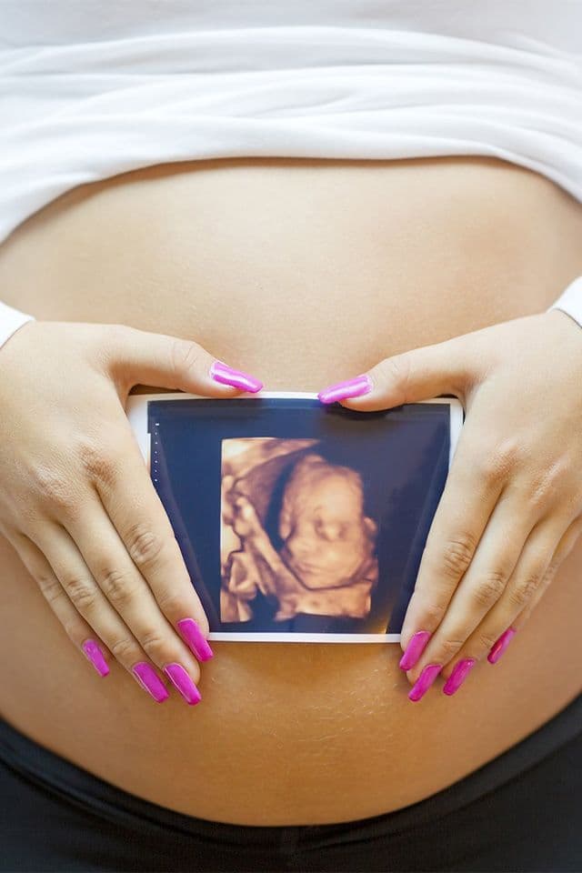 Dia das Mães – Tecnologia da Ultrassonografia 3D e 4D